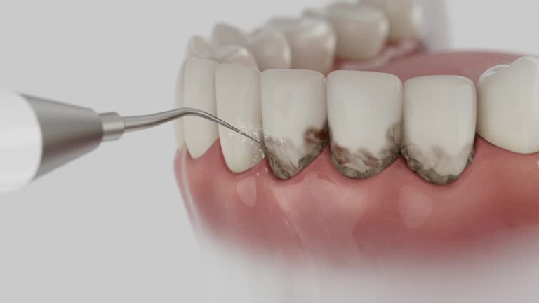 Trusted Wisdom Tooth Removal service in North El Monte, CA - Dentist Open Now